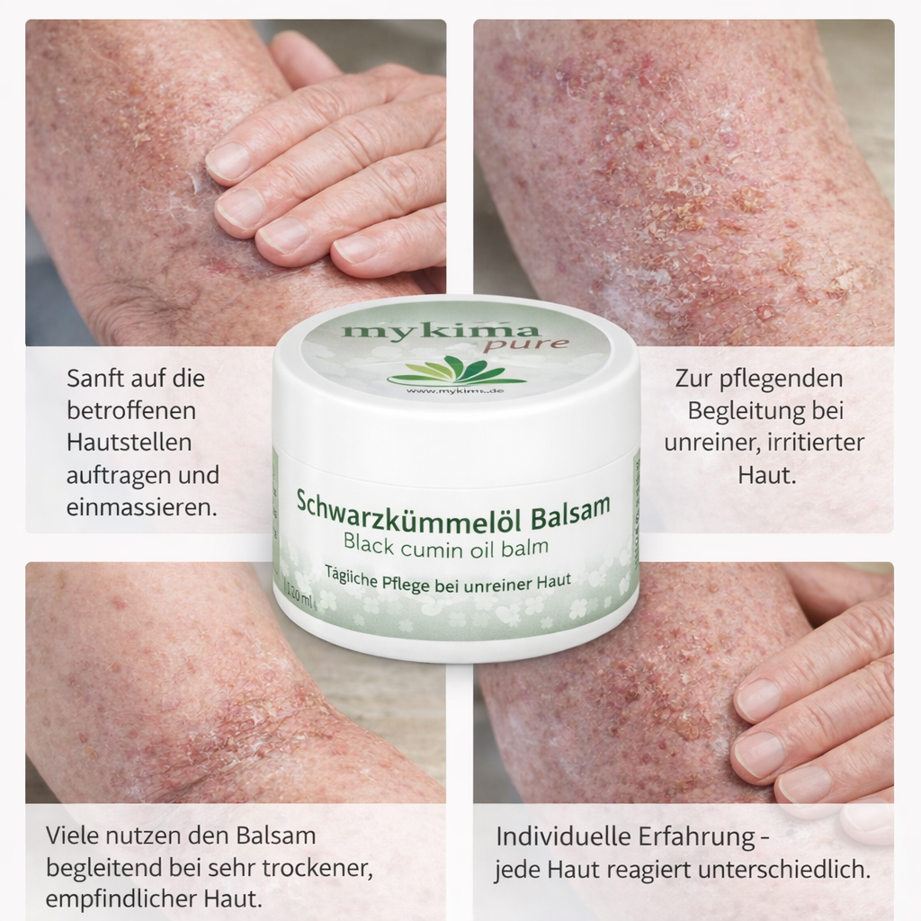 Schwarzkümmelöl Balsam 200 ml – Pflege für empfindliche & beanspruchte Haut | mykima®