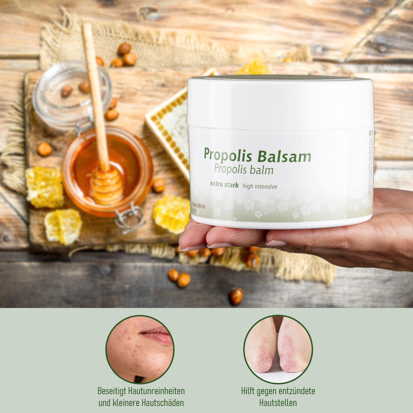 Propolis Balsam extra stark 200 ml – Pflege für belastete Haut | mykima®