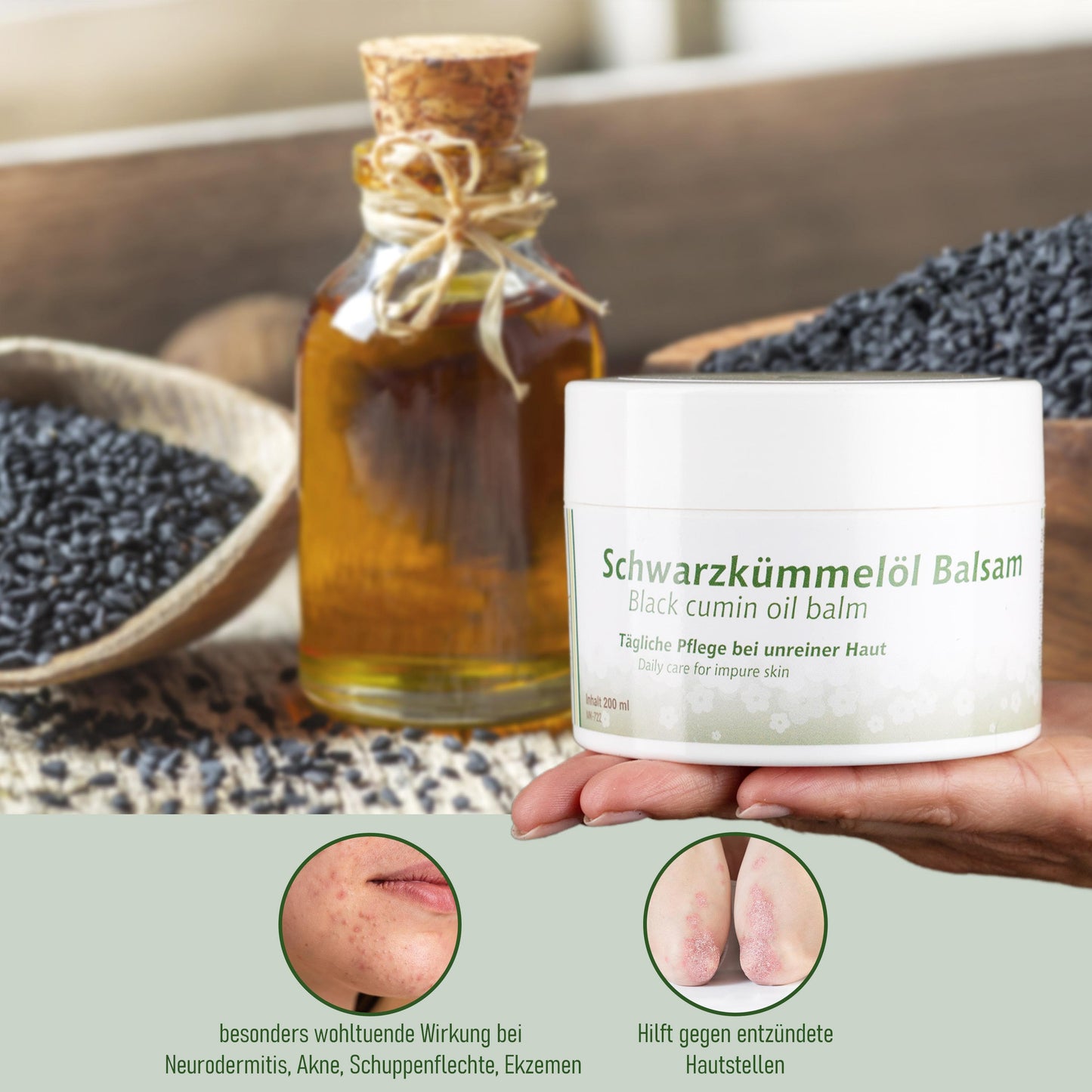 Schwarzkümmelöl Balsam 200 ml – Pflege für empfindliche & beanspruchte Haut | mykima®
