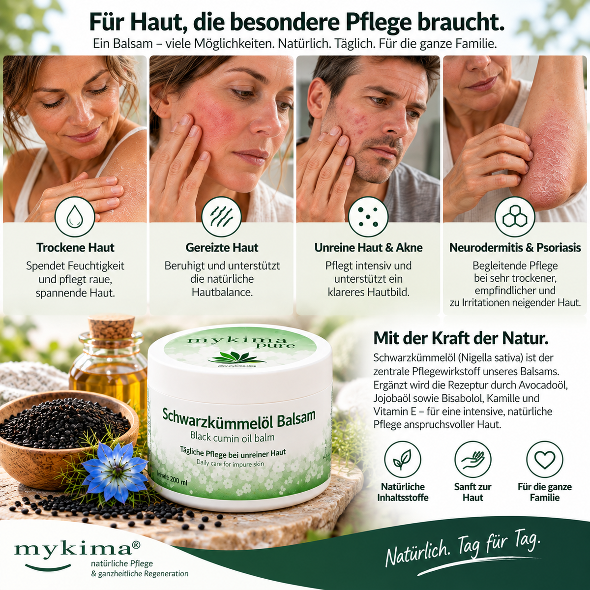 Bei Neurodermitis, Psoriasis, Akne und unreiner oder empfindlicher Haut Schwarzkümmelöl Balsam 200 ml | mykima®